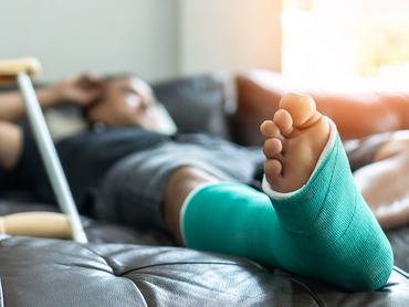 Csonttörés a lábfejben és a lábszárban egy férfi páciensnél, sínekkel rögzített gipsszel és mankókkal, a műtét utáni rehabilitáció és az ortopédiai gyógyulás ideje alatt, otthoni ápolás mellett