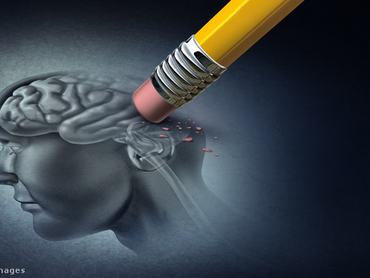egy emberi fej rajzán az agyat egy ceruza radírjával törlik ki utalva ezzel az Alzheimer-kórra